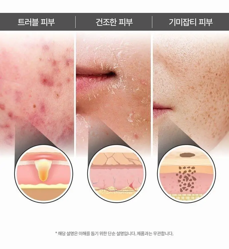 [종합장벽][바이오크림] 지피덤 셀트리온EGF 스킨베리어 인텐시브 크림 80ml 상세페이지 17